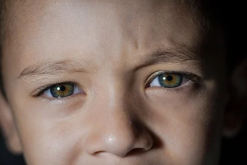 ما هي الهالات السوداء و أسبابها عند الأطفال